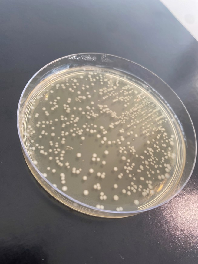 Lactococcus Plate What is the role of bacteria in yoghurt and fermented milk products? | Arla
