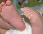 Dermatitis del pañal: consejos para evitar irritaciones en el culito del bebé