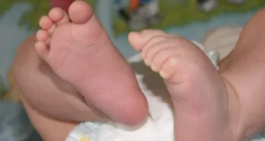 Dermatitis del pañal: consejos para evitar irritaciones en el culito del bebé
