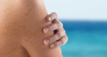 Beneficios del agua del mar para nuestra piel